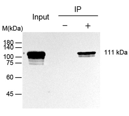 His Tag小鼠抗體-輝駿生物.jpg His Tag小鼠抗體-輝駿生物.jpg